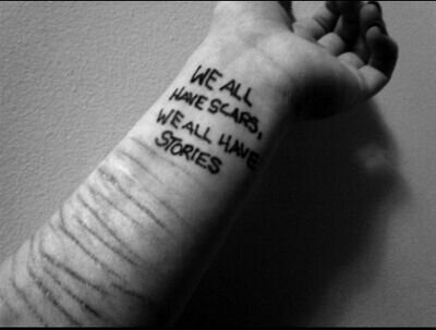I'm Broken, I Hate Myself, I Dont Want To Live, I Deserve To Be Dead... My Followers I Have One Message. Stay Strong. 3