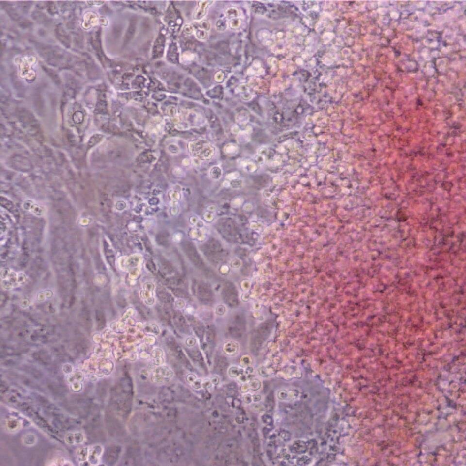 The goal of PCBC is to identify and characterize progenitor cell lineages, to direct the differentiation of stem and progenitor cells to desired cell fates...