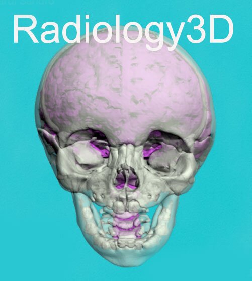 Il blog  sulle moderne tecniche diagnostiche in campo odontoiatrico, e sull'odontoiatria a 360°  http://www.radiology3dblog.comhttp://www.radiology3d.com