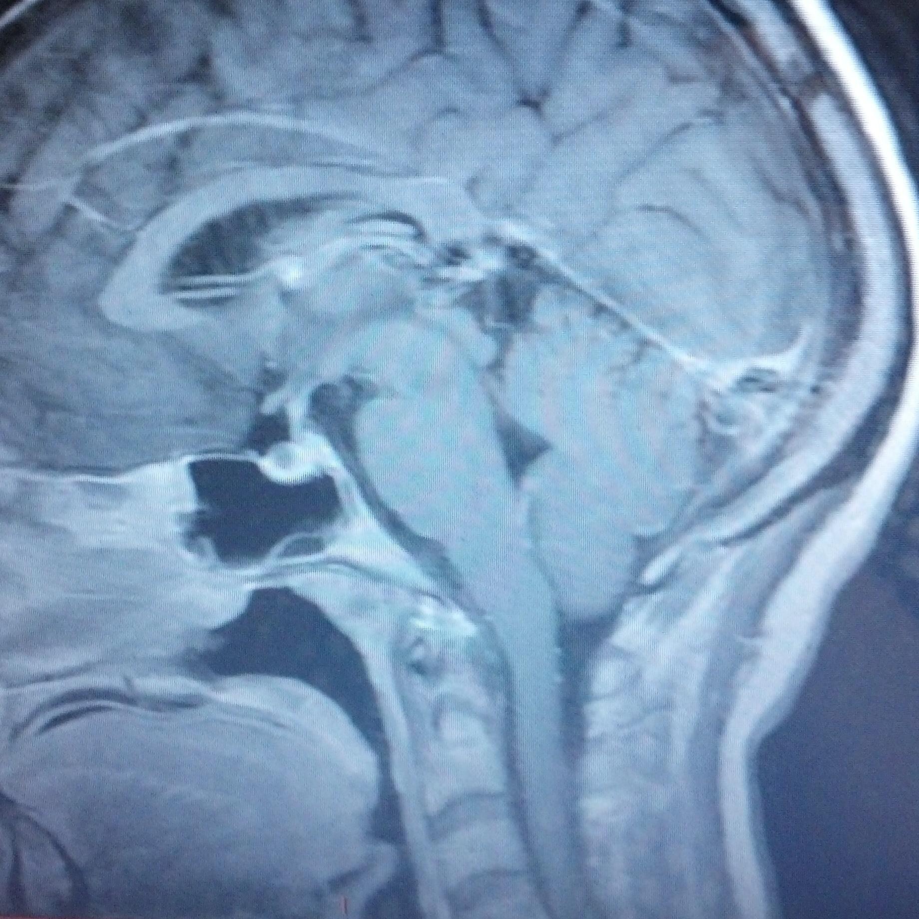 My sons Hero! Looking for the Blessing in Disguise! Music, Art, Wine & Food. Professional Patient, Seeker of Information