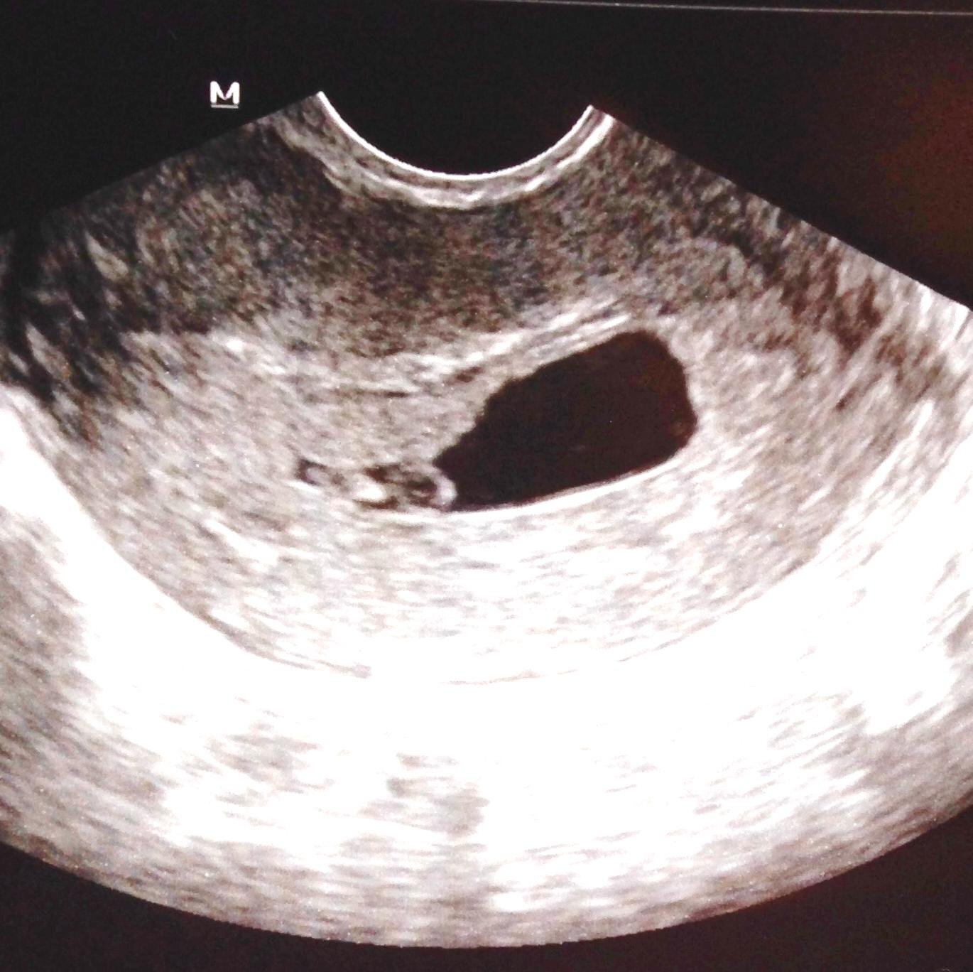 ItsLightOng's profile picture. This is the story of my life as told by my parents (@denseymour @ceena_ong) for now. Soon, I'll be the one to share my adventures and discoveries in life.