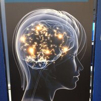 GCU_Stroke (@gcu_stroke) 's Twitter Profile