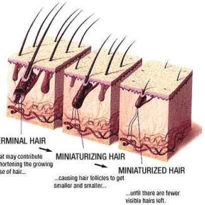 Open group of researchers and investigators raising awareness about androgenetic alopecia, helping in find causes and cures