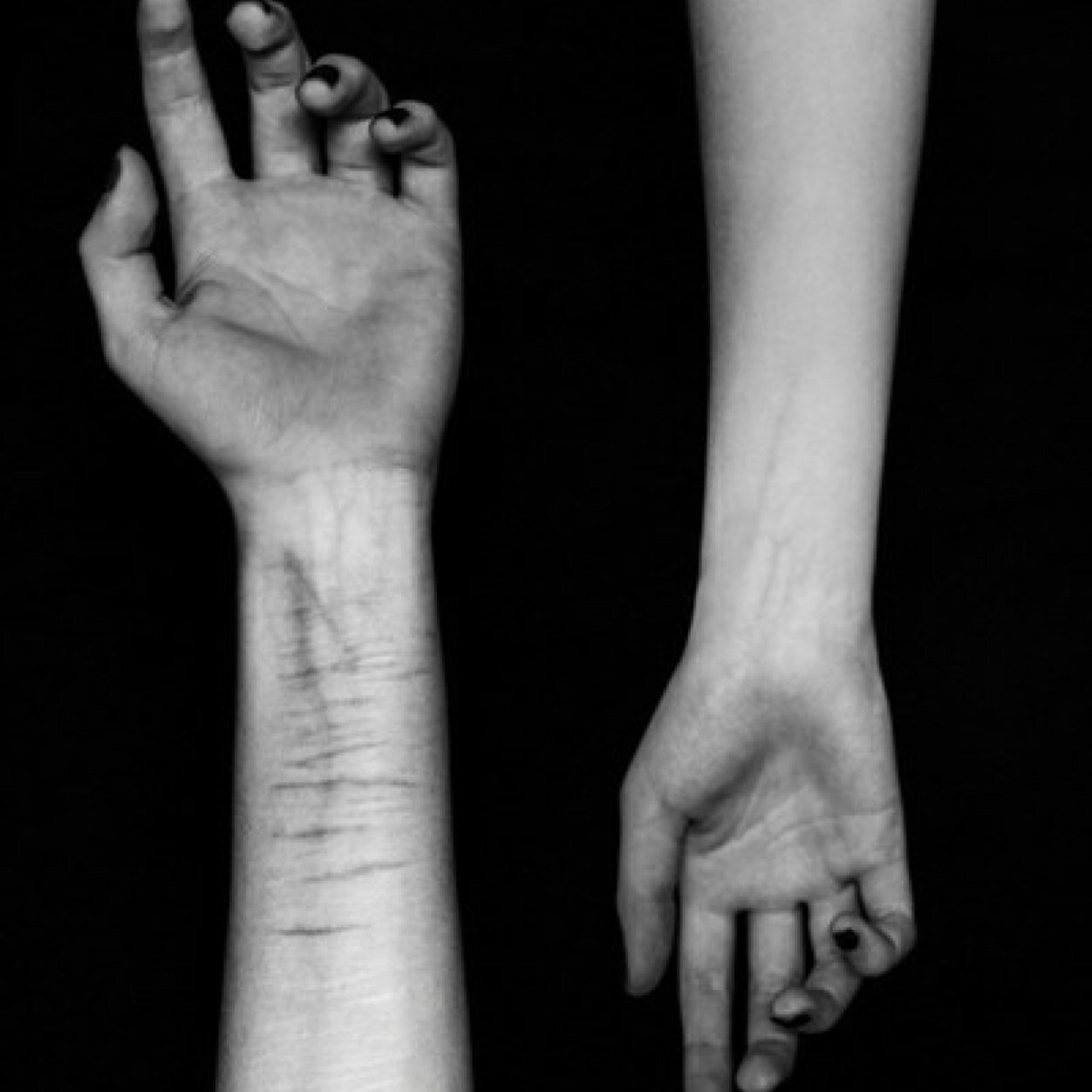 inside_died's profile picture. Lesbian • Depressed • Anorexia • Bipolar • objectif 50 kg • passée de 72 à 64 •