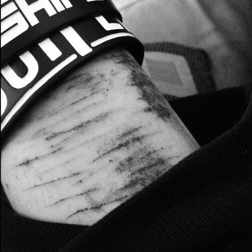 boy. ugly. alone. cutter. self-mutilator. unhappy. hopeless. fat. insecure. bulimic. imperfect. depressed. worthless. etc.. You can call me Charlie.
