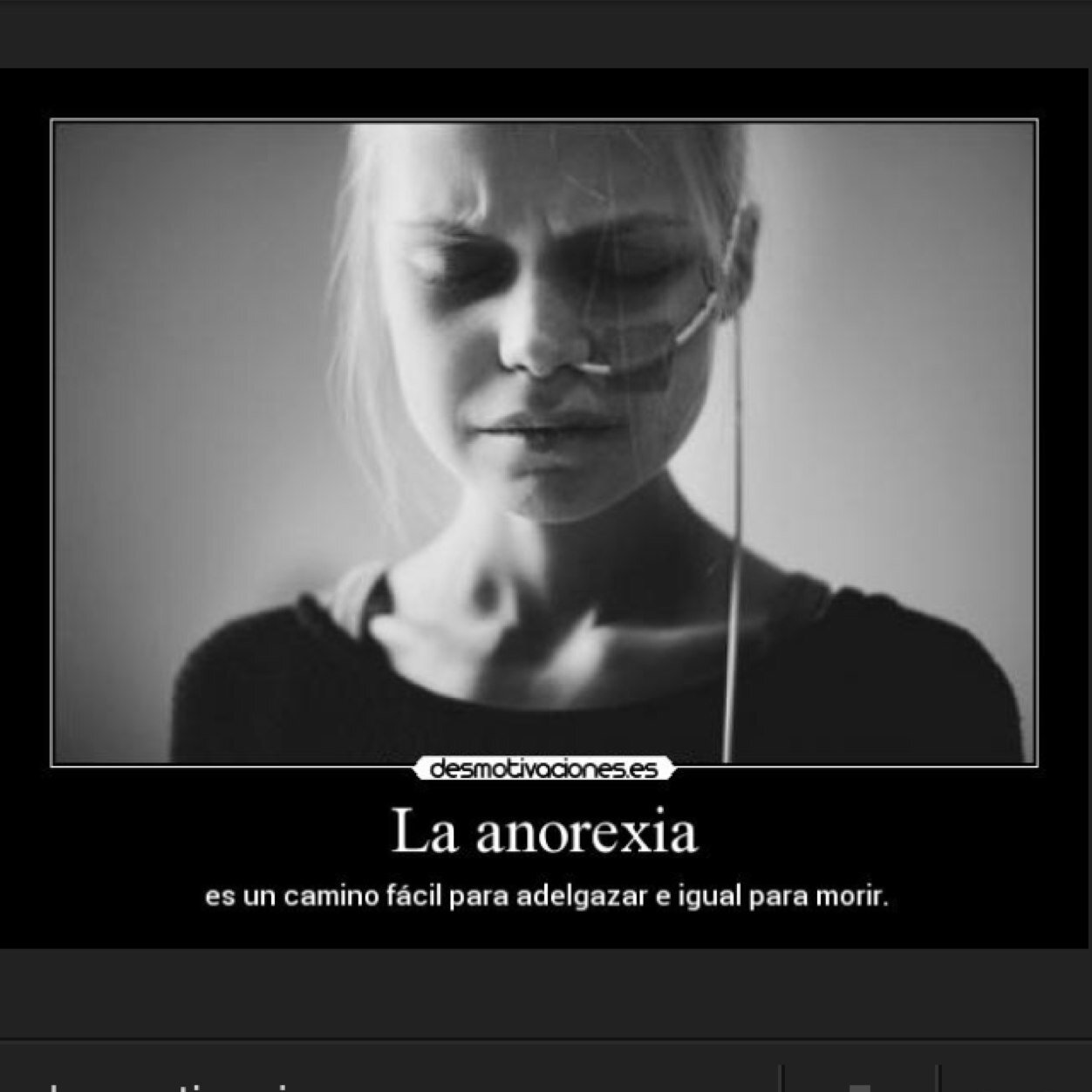 ANOREXIA NERVIOSA ~Maximo:52 Actual:52 Meta:40 Soy una gorda y asquerosa ballena Cosas que me gustan de mi: nada Cosas que odio de mi: yo