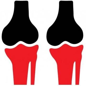 PainFreeJoints1's profile picture. The best natural remedies for joint pain!