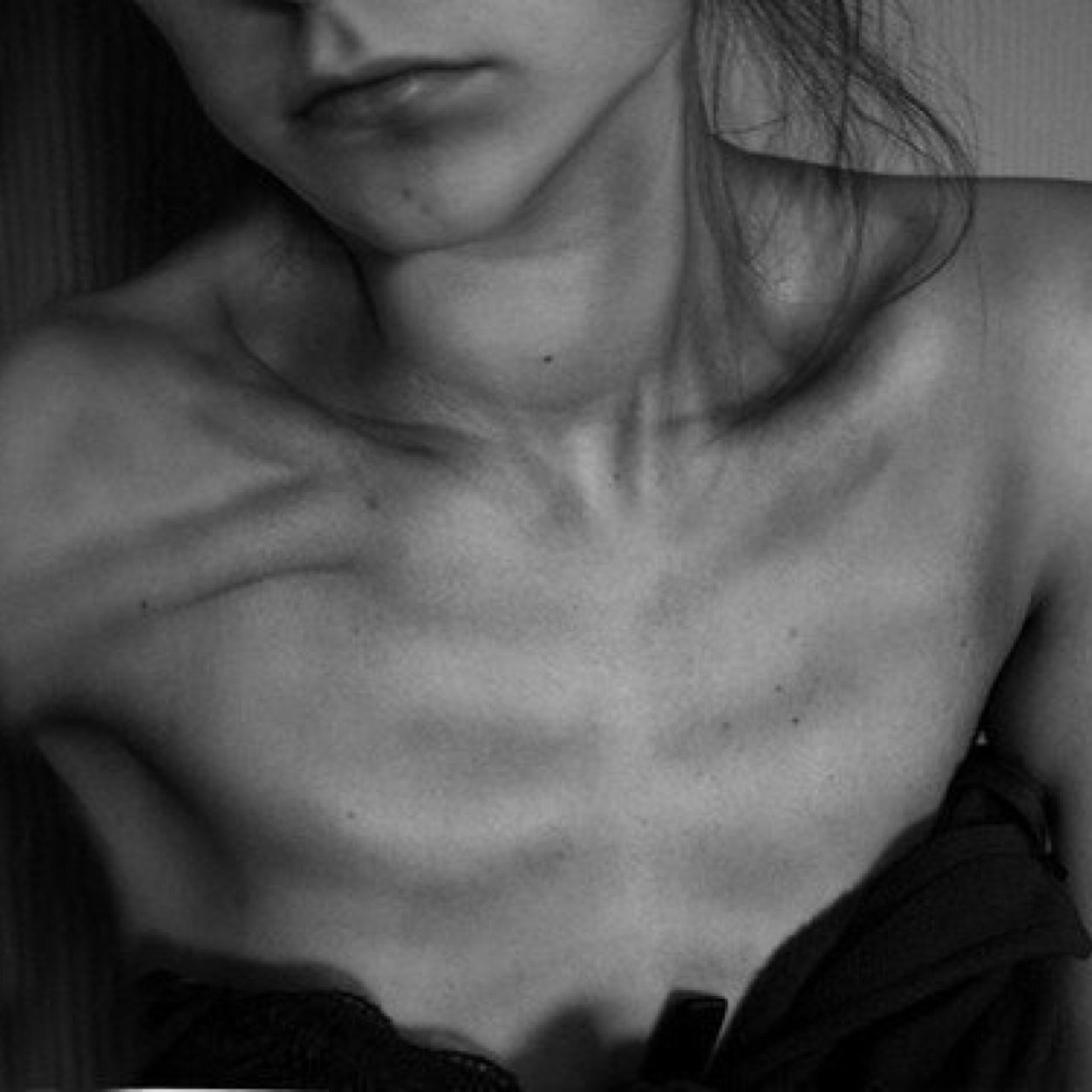 Clinically Depressed, Bipolar, Suicidal, Self Harm, Fat