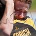 Santi Freixa Escude (@blognetsporting) Twitter profile photo Santi Freixa Escude (@blognetsporting) Twitter profile photo