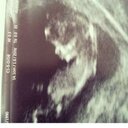 Erasmo Gil - @Eagil90 - Twitter