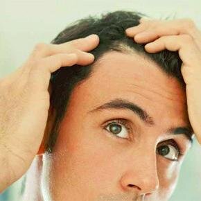 Hair loss tips, guide and useful resources.