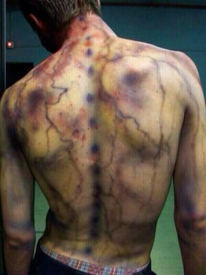 I was struck by lighting 2 days ago //not rp account anymore\\