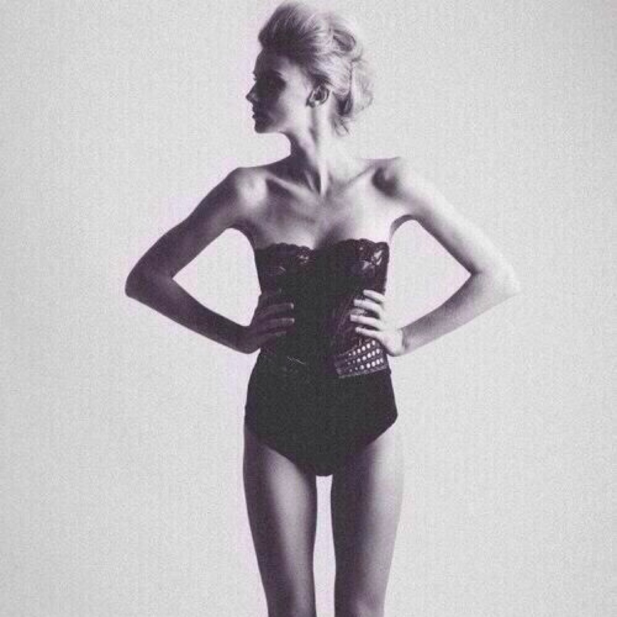 18. Depressed and always hungry •Recoveing from anorexia (failing at it). H:|5'9| SW:|134| CW:|133| GW:|125| UGW:|115