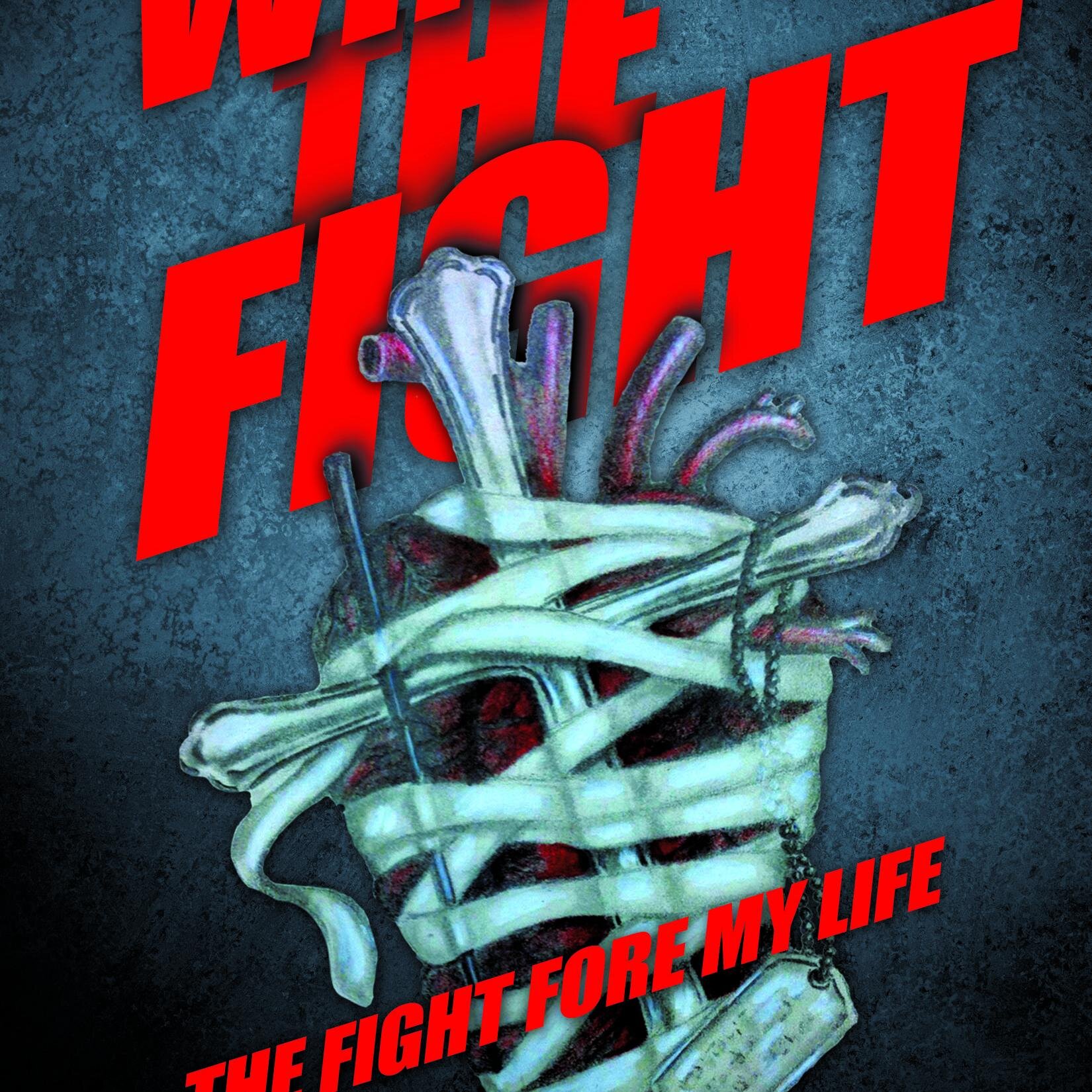 Win The Fight - The Fight Fore My Life

An incredible story on how at just 19 years of age @jgant474 overcame all odds in the fight fore his life. #donatelife