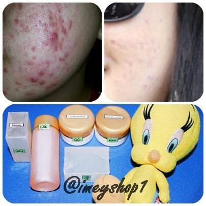 imeyshop1's profile picture. 