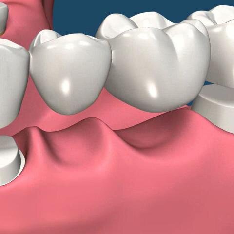 coronasypuentes Profile Picture