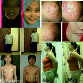 Solusi sehat alami, hubungi 089639071002 :) free konsultasi :D