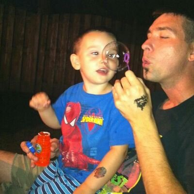 ShawnsAspsFight's profile picture. Last year Shawn was diagnosed with stage 4 Alveolar Soft Part Sarcoma... It is an extremely rare cancer. prognosis is poor, but his spirit and hopes are high.