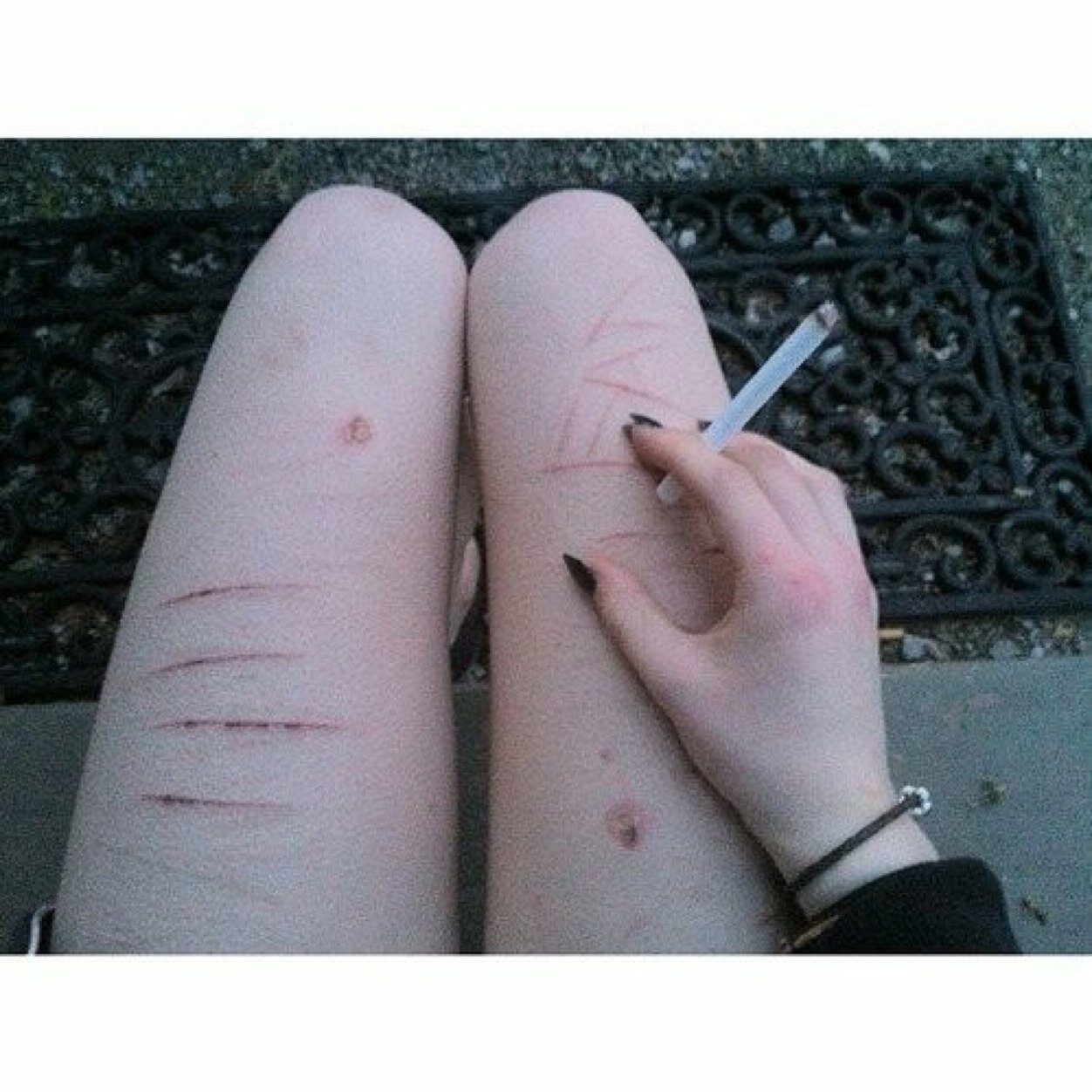 Anorexia. Depresión. Ansiedad. Entrar en una 32, por favor. «Pretty girls don't eat.»
Tabaco y café.