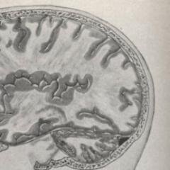 DespairsDoctor's profile picture. Aww, what's wrong? You thought I was gone? Ehahahaaaa! No no. I have...patients to test...! (Post-Despair of @SHSLPsychology)