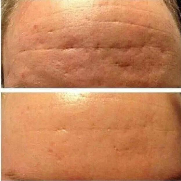 skinsaving4u's profile picture. Provides skin and wellness articles and tips!