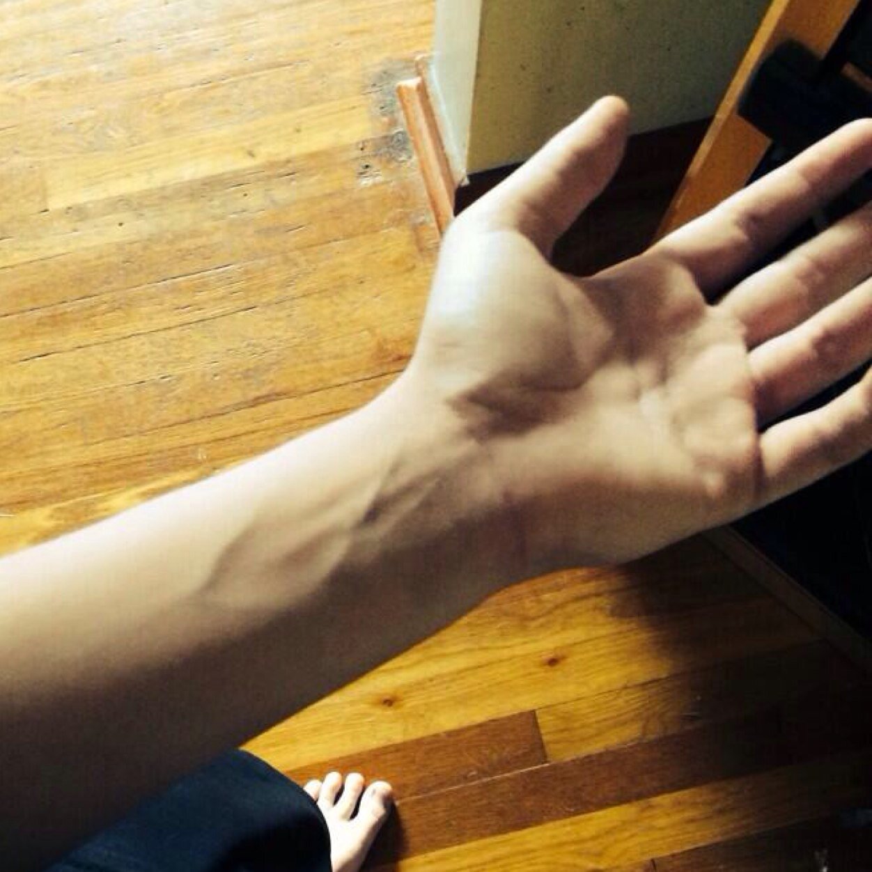 A Page Dedicated To Cody Herbinko's Veins