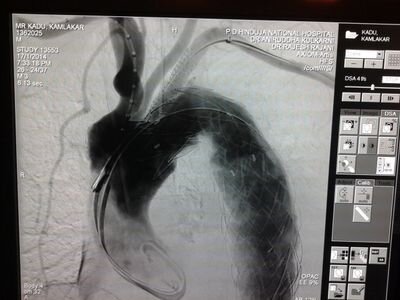 Interventional Radiologist