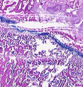 Cryptopathology is a new discipline investigating the origin, nature and course of diseases in cryptids.