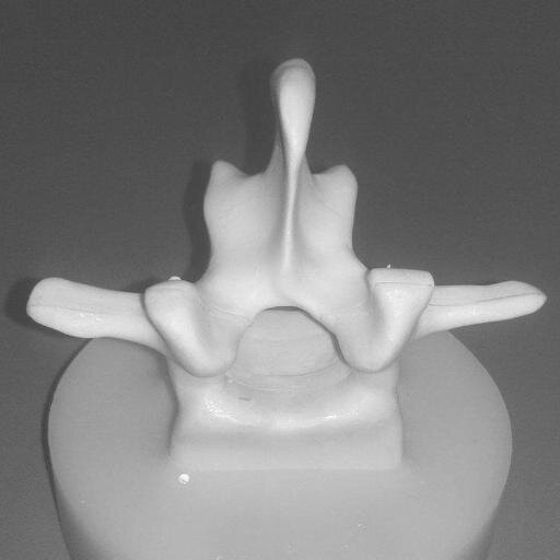 The Research Group for Surgical Simulators Linz (ReSSL) is developing Hybrid Surgical Simulators.