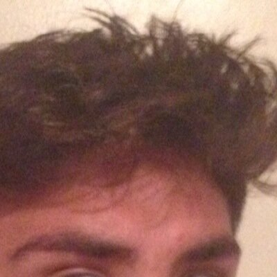 Living my life hairy