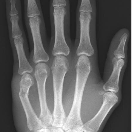 Hier twittert medtech-blog.de über Medizintechnik und digital Healthcare
#Medizintechnik