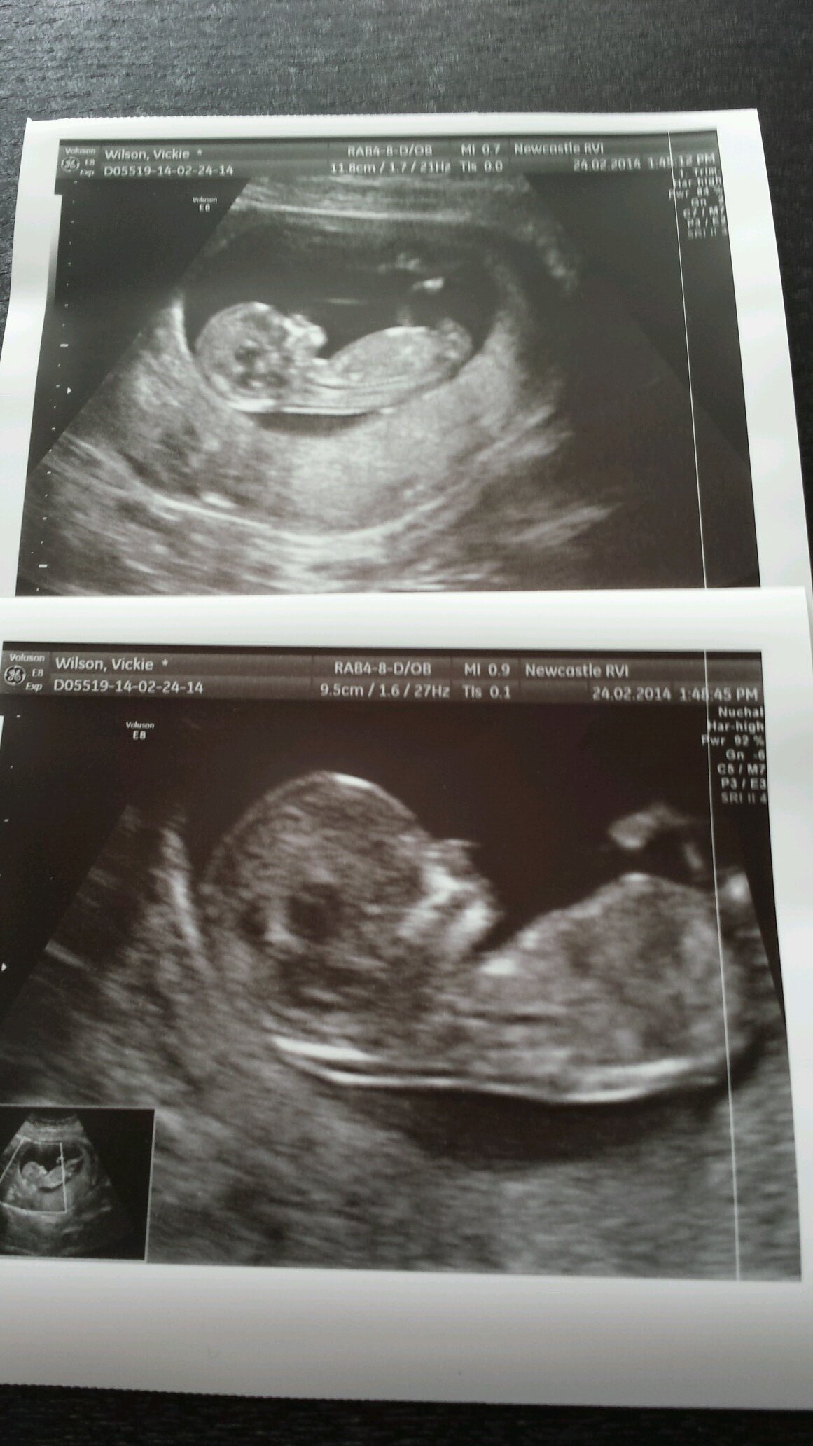 VickieWilson22's profile picture. Love life....live it to the fullest.... Keep all the people who make you smile close by xxx