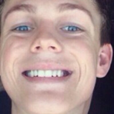 This is dedicated to Caspar's flawless ears. Follow @DEYESeemerollin