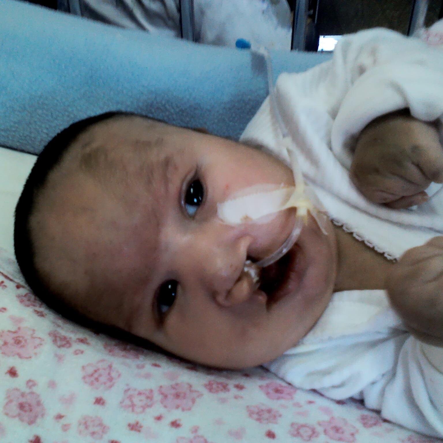 esta niña fallecio a los 20 días de nacida:( la doctora no vio k ella tenia esta enfermeda y fueron a demandar a los doctores y perdimos :( .l.