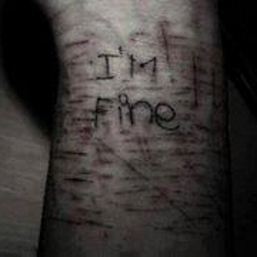 Todo sana con una autolecion(:Ana&Mia Por Siempre#HELPME