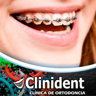 Clinident Clinica De Ortodoncia, La Clinica Dental No.1 en Monclova, Coahuila,