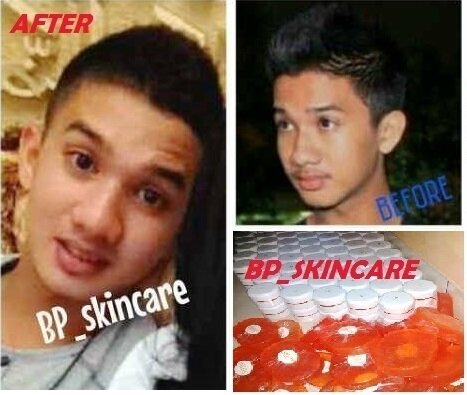Suppplier BP skincare . . . Ingin tw info'a ?? Invite 2771f906