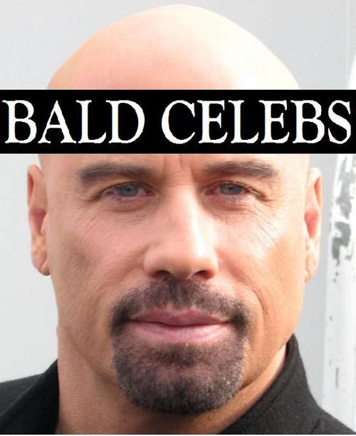 Bald/Balding Celebrities!