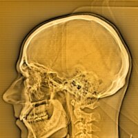 MedicalDevicesLegal (@meddevlegal) 's Twitter Profile Photo MedicalDevicesLegal (@meddevlegal) 's Twitter Profile Photo