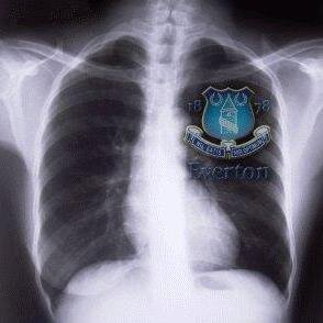 #EFC STH, @TGFDeliberation @EvertonInUSA @SanDiegoToffees @EvertonUSA
