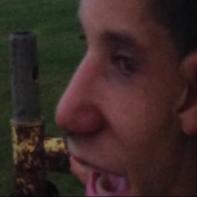 When gino is sick its like his nose is on its period