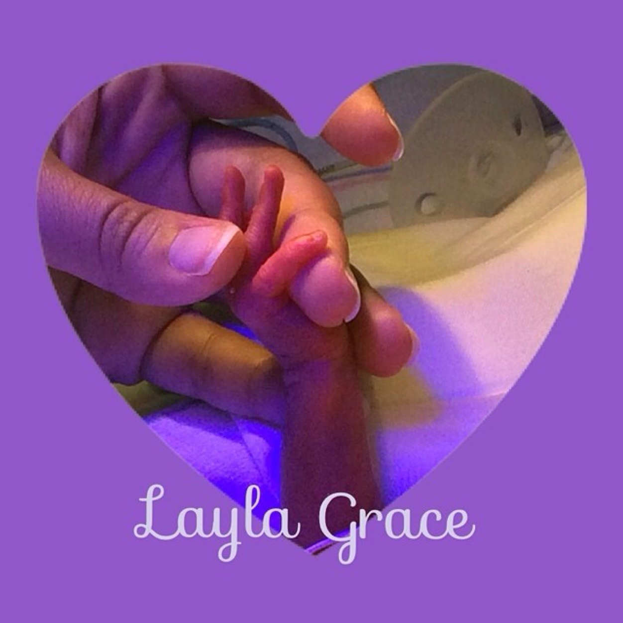 EmilyDiaz83's profile picture. My life is about God, Hubby, My preemie Layla Grace (born 7/9/2014 at 26 weeks & 4 days 1lb 13oz), & my maltese Ellie. Pray for Layla Grace!