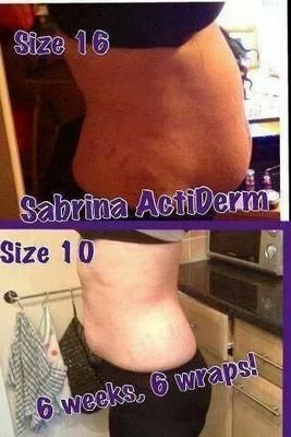 ActiDerm Consultant, join my group for feedback, competitions and offers http://t.co/poY9o23ViH