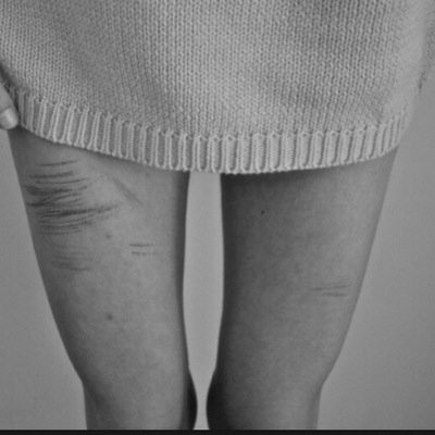 AnaXsuicidalXdepressed/ kill me before i kill myself