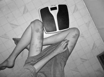 After all, how can you run from what's inside of you ?15 years, dutch, self hate, self harm && hate eating. (secret account)