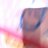 cildu_