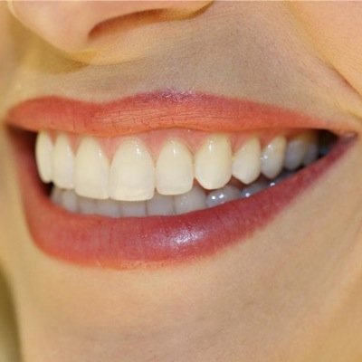 Odontología Integral. Atención a niños y adultos. Contamos con todas las especialidades. Precios accesibles. 70210637/5514908906