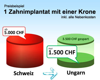 Wir organisieren Zahnbehandlungen in Ungarn. Melden Sie sich jetzt an.