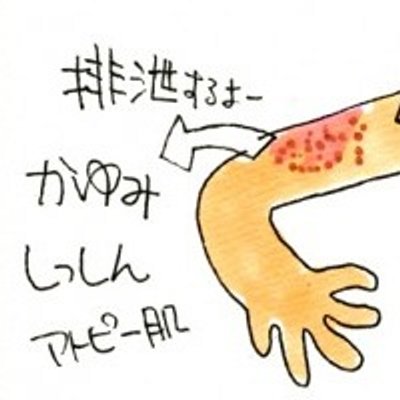 アトピーは辛い Atopi Twitter