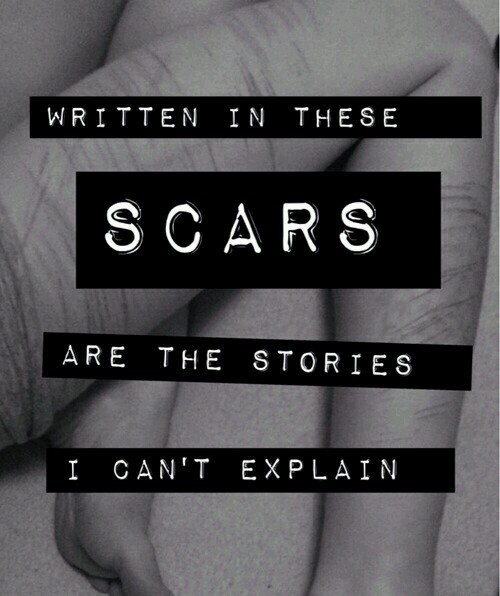 《I'm just another girl who hide scars》                  PI: 89 PA: 67 M1: 57